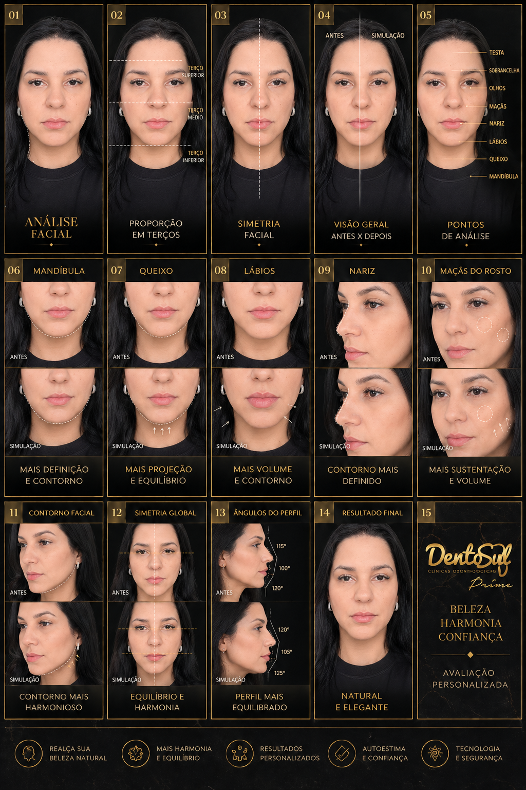 Análise facial Dentosul Prime — proporção, simetria, pontos de avaliação e simulação antes/depois